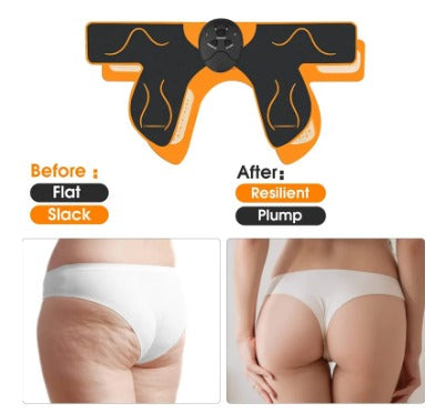 GluteoUp (Kit Levanta Glúteos)